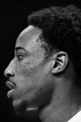 DeMar DeRozan Poster 3389336